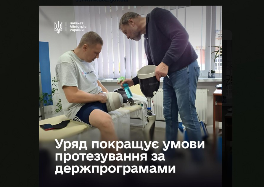 Уряд оновив умови протезування для складних ампутацій