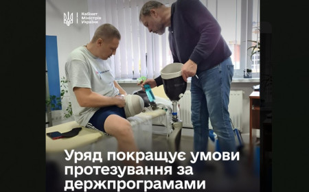 Уряд оновив умови протезування для складних ампутацій